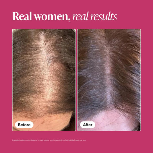 Hair Growth Supplement for Women Viviscal – 60 Tablets